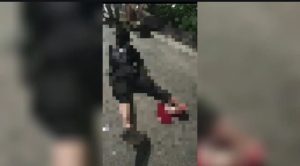 Viral di Medsos Korban Begal, Pria Kaki Putus Dekat Seasons City Ternyata Korban Kecelakaan