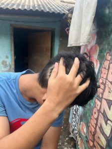 Diduga Salah Seorang Ketua RW di Semper Timur Aniaya 5 Bocah di Bawah Umur Hingga Babak Belur
